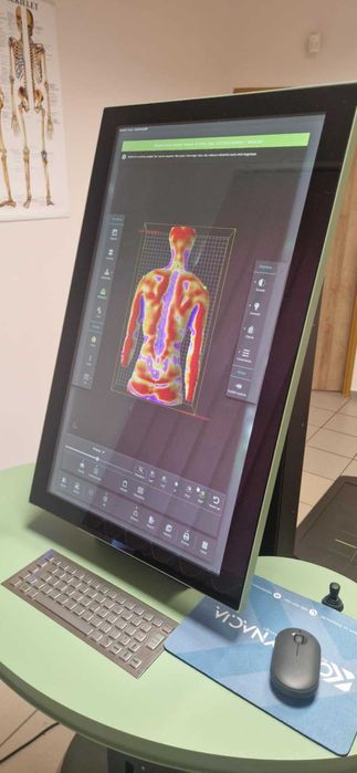 SPINE 3D (2024) – urządzenie do bezpromieniowej analizy postawy ciała