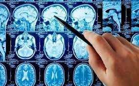 Курси для студентів медиків,Неврологія, for medical students,Neurology