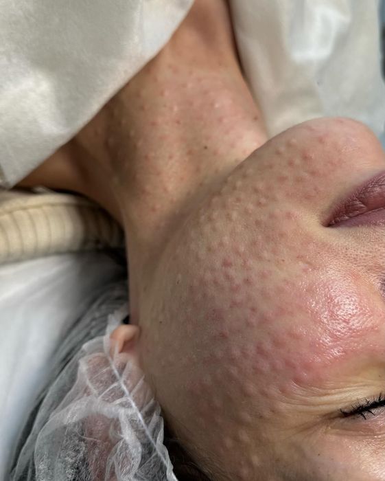 Косметолог,досвід  11 років.