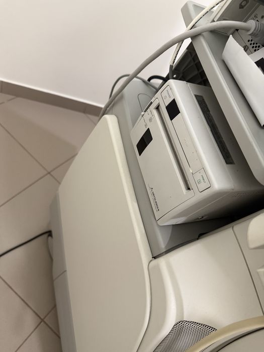 Узд, ультразвуковий апарат Philips iu22