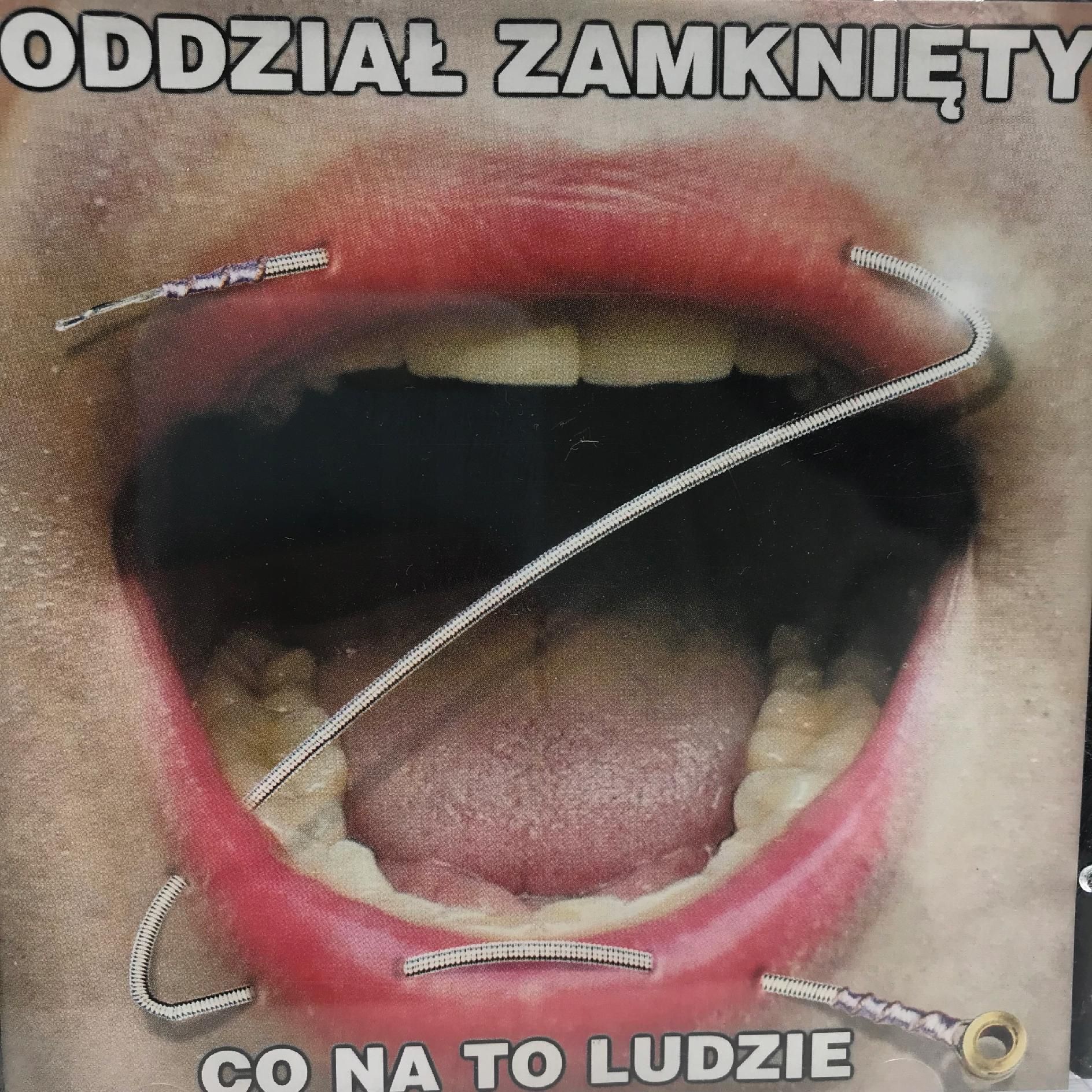 cd - oddział zamknięty - co na to ludzie