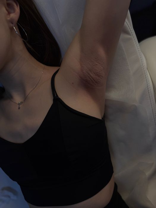 Депіляція електроепіляція чоловіча та жіноча ламінування вій Оболонь