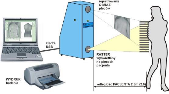 System Mora 4HD - komputerowe badanie postawy ciala