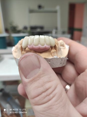 Зубний технік кераміст
