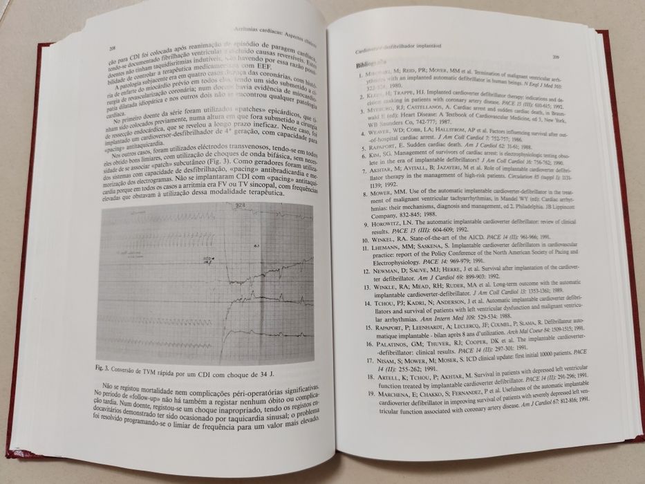 Livro: Arritmias Cardíacas - Aspetos Clínicos - J. Lopo Tuna
