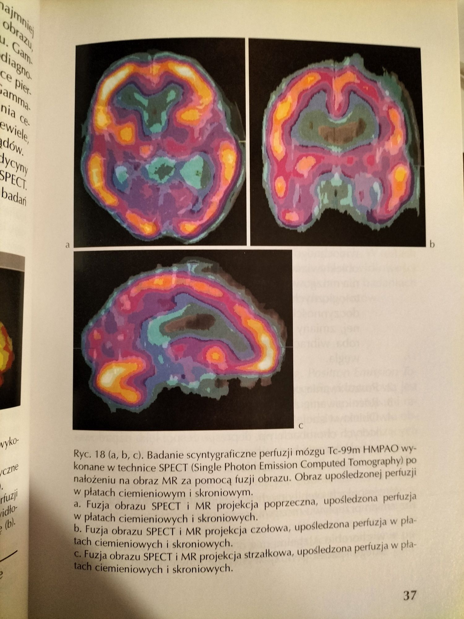 Neuroobrazowanie w praktyce psychiatrycznej