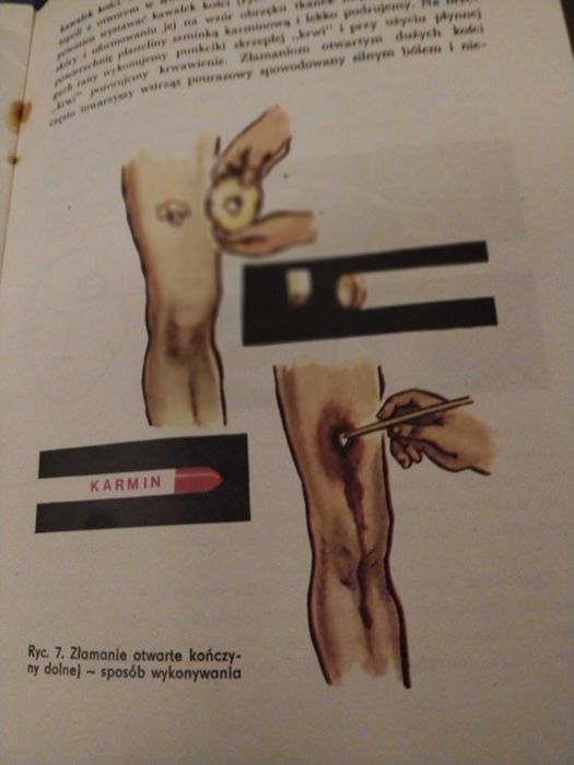 Instrukcja pozorowanie zranień i innych urazów obrona cywilna