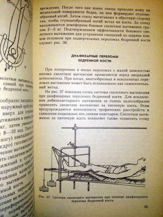 Ключевский Скелетное вытяжение 1991
