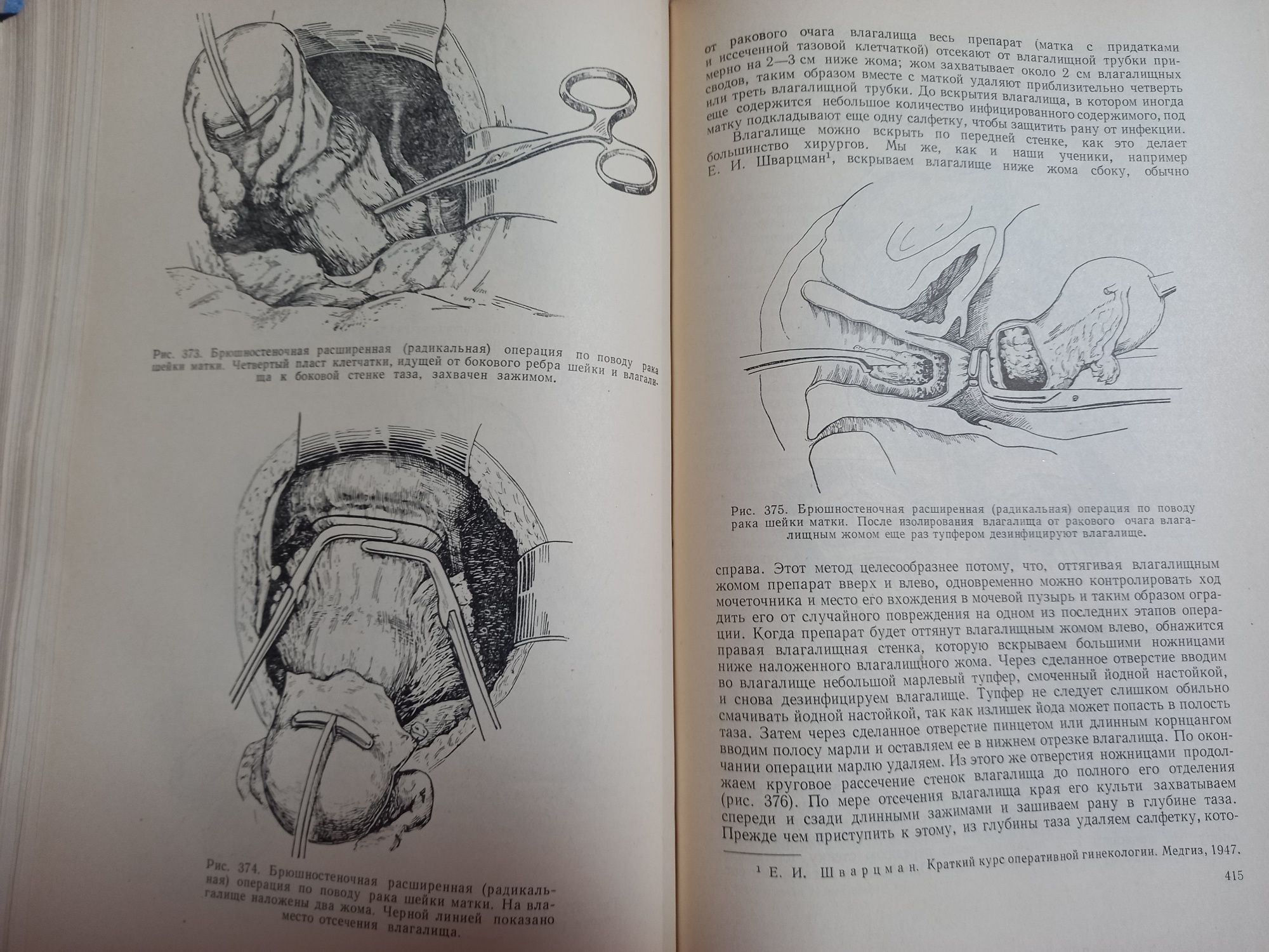 Книга"Оперативная гинекология"