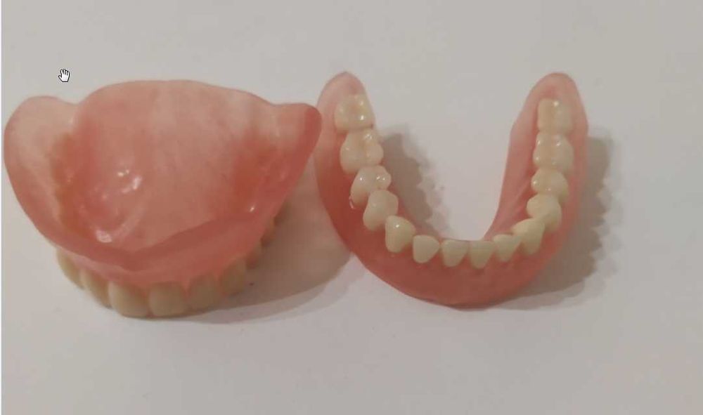Зубний протез \акриловий\