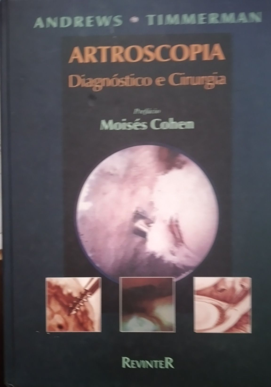 Artroscopia diagnóstico e cirurgia