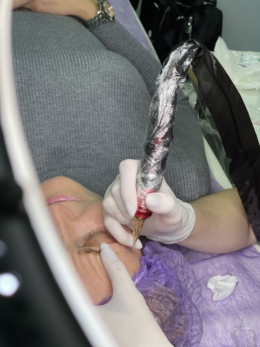 Видалення тату і перманентного макіяжу будь якої складності від 500грн