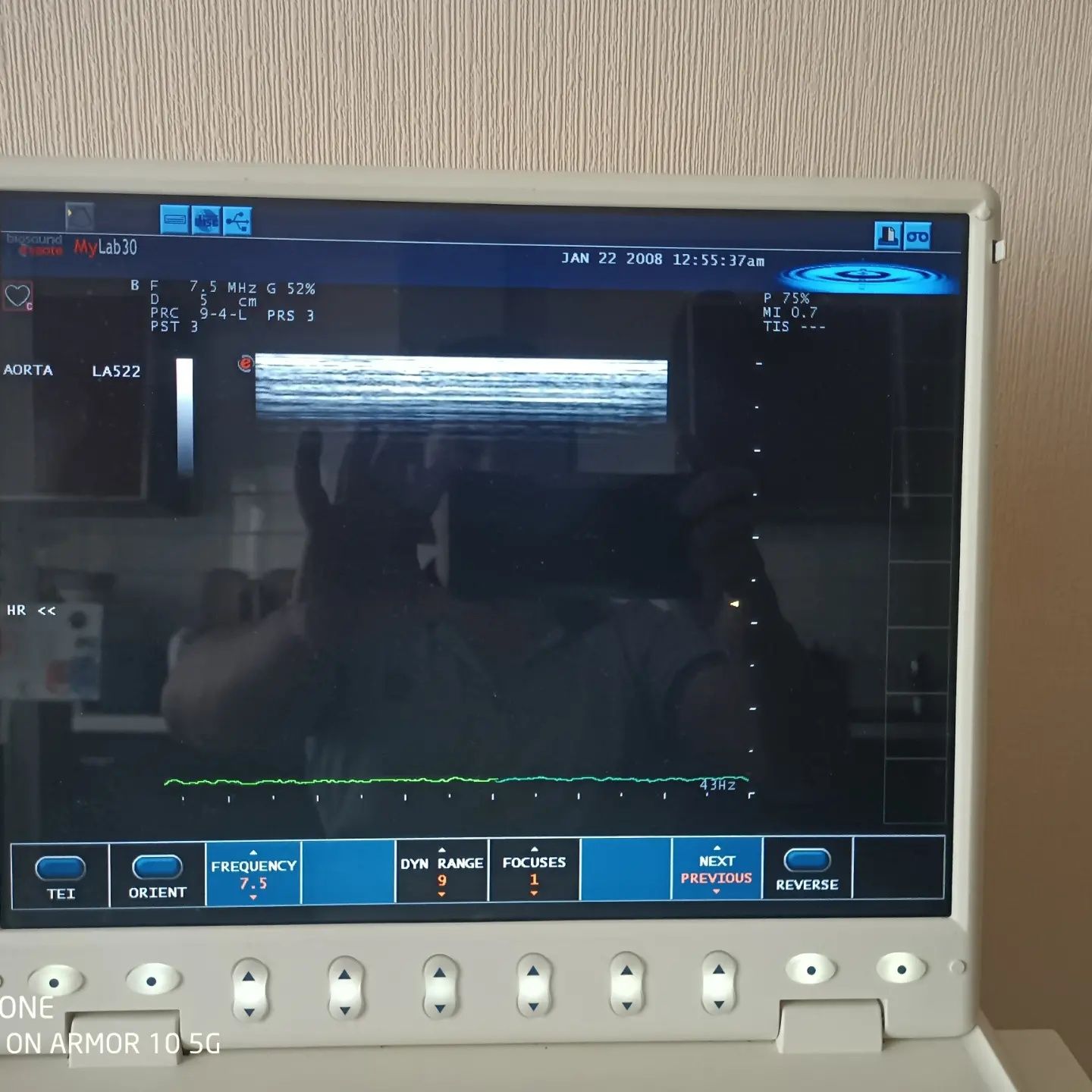 Портативний узд апарат Esaote my lab 30 cv CARDIO УЗИ 2009 р.в.
