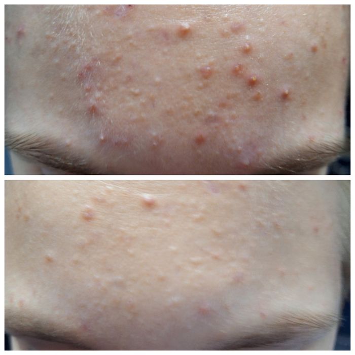 Косметолог з медичною освітою. Апаратний антицелюлітний масаж.