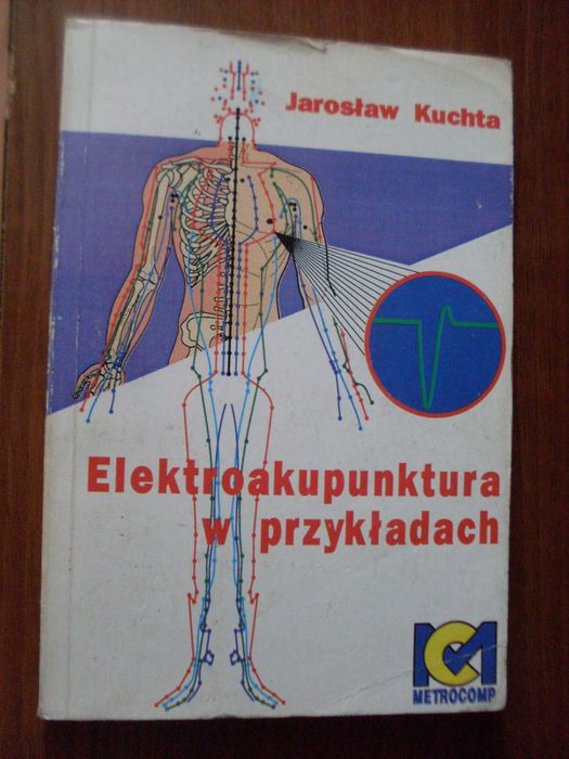 Jarosław Kuchta Elektroakupunktura w przykładach