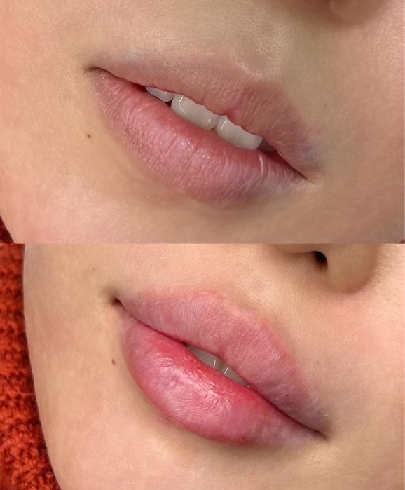 АКЦІЯ  Губи від 1500 грн, модель по собівартості, Київ, палац Україна