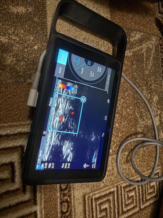 УЗД   SONOSITE iViz Portable  Ultrasound.