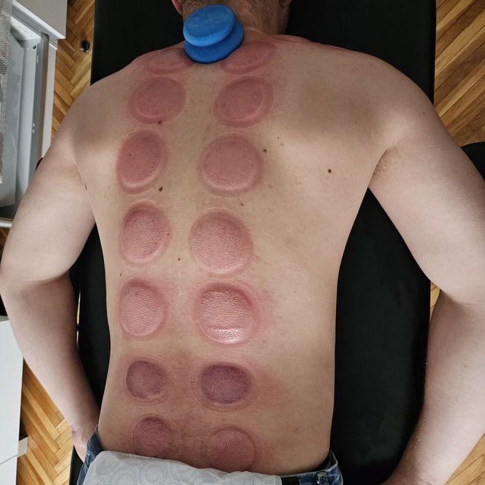 Masaż • Terapia manualna • Rozluźnianie mięśni i powięzi z dojazdem