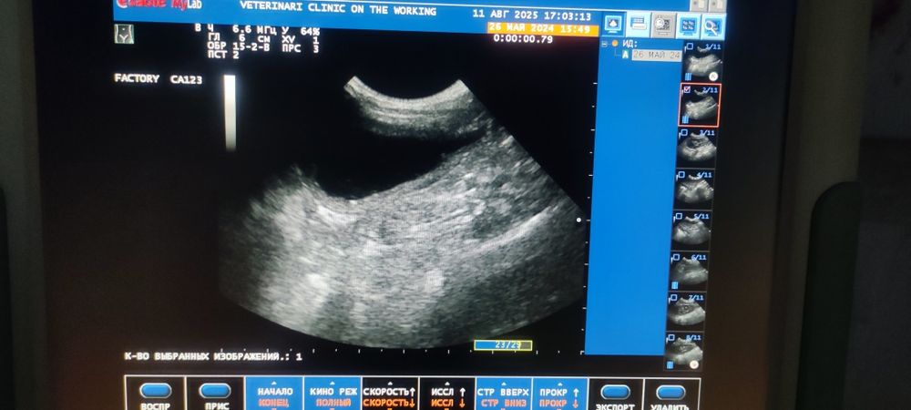 УЗД апарат. Esaote MyLab 40