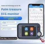 Wellue Viatom кардіомонітор Pulsebit EX EKG checkme plus