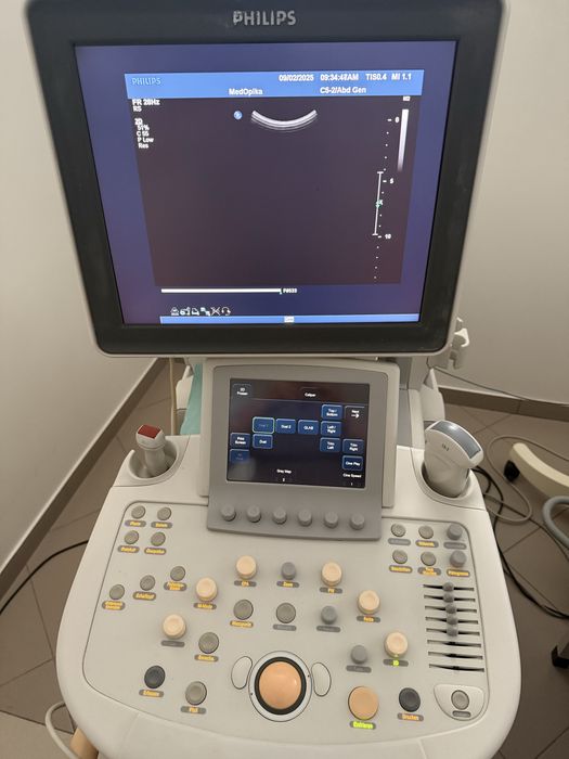 Узд, ультразвуковий апарат Philips iu22