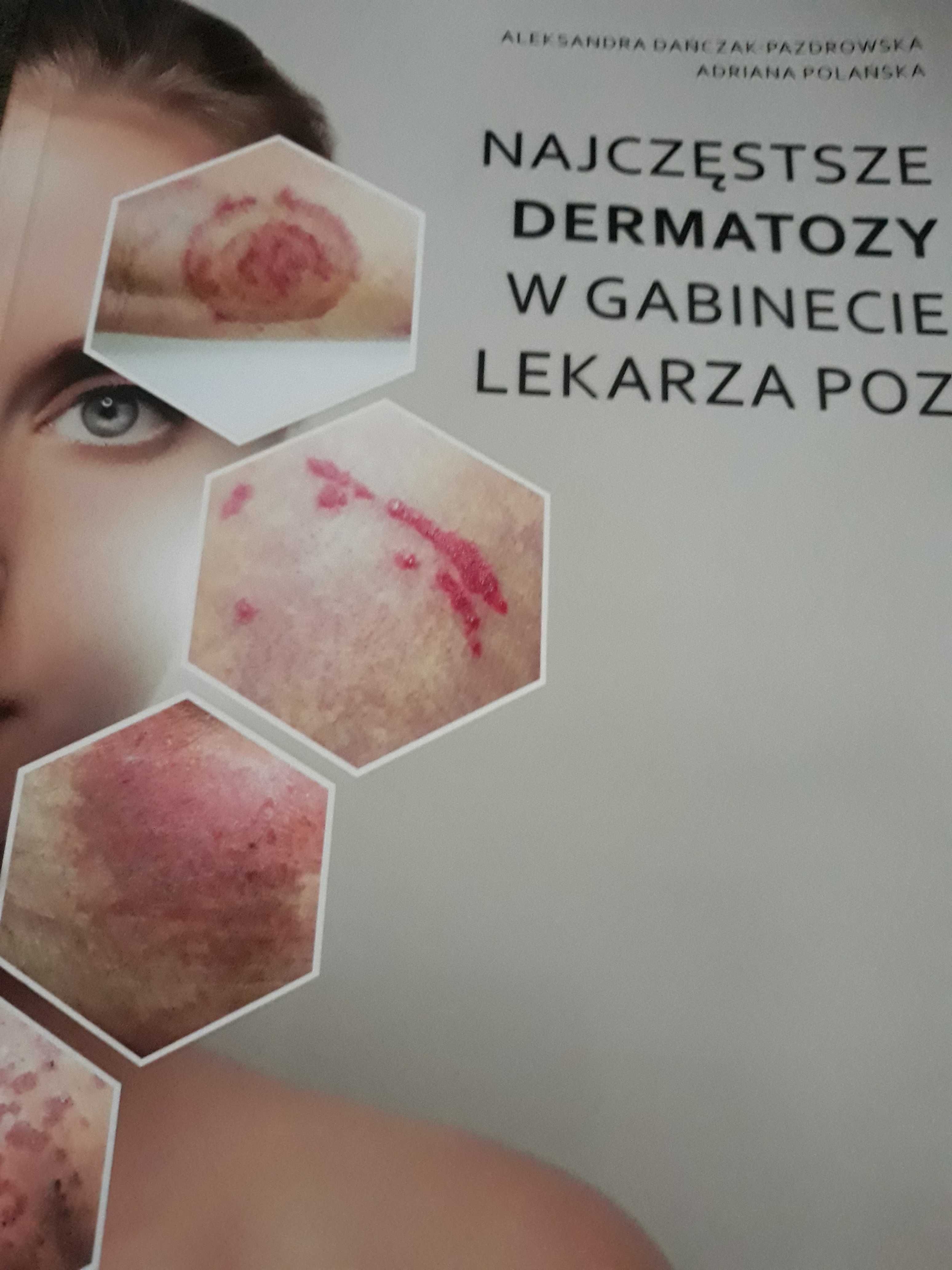 Najczęstsze dermatozy w gabinecie lekarza POZ