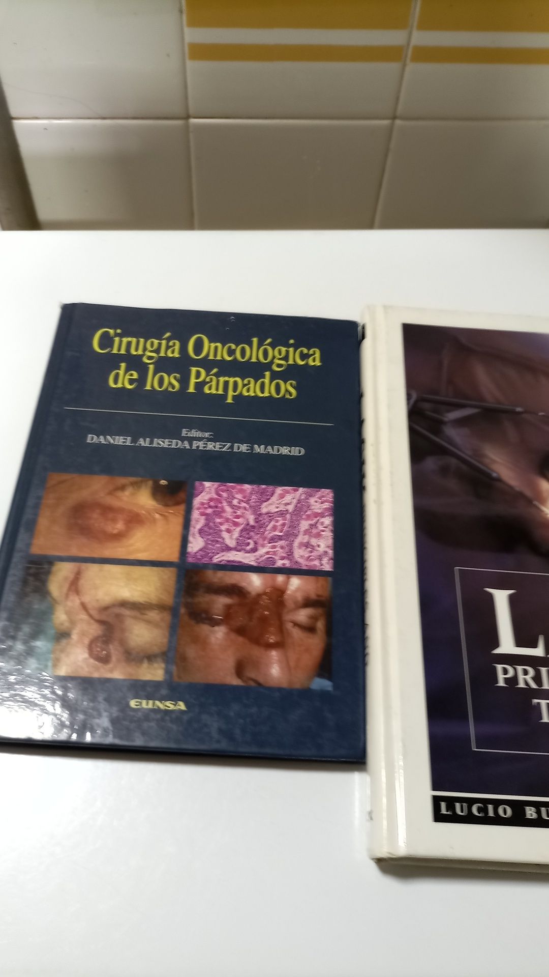 Livros de medicina oftalmologica