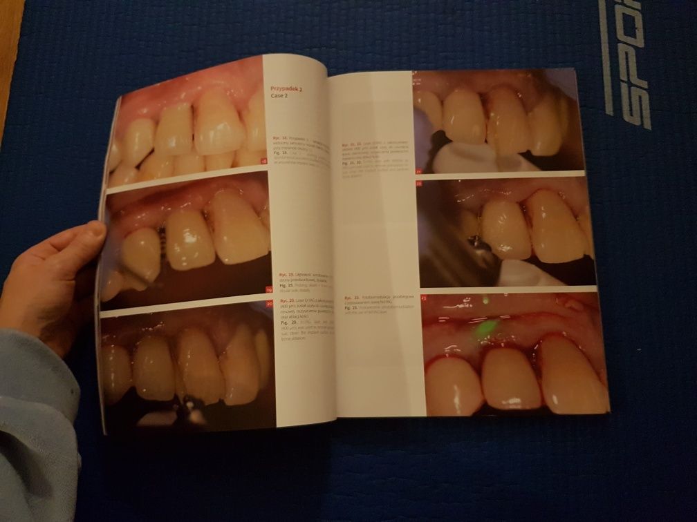 E-dentico branżowe czasopismo stomatologiczne 4(72)/18