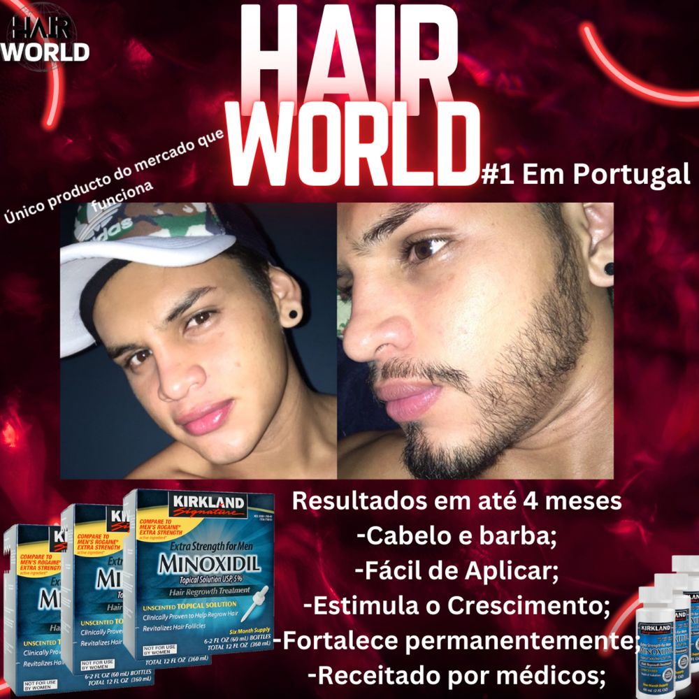 Minoxidil Original da Kirkland