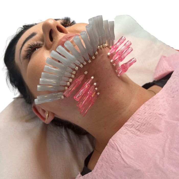 Uslugi medycyny estetycznej (botoks, stymulatory, kwas hialuronowy)