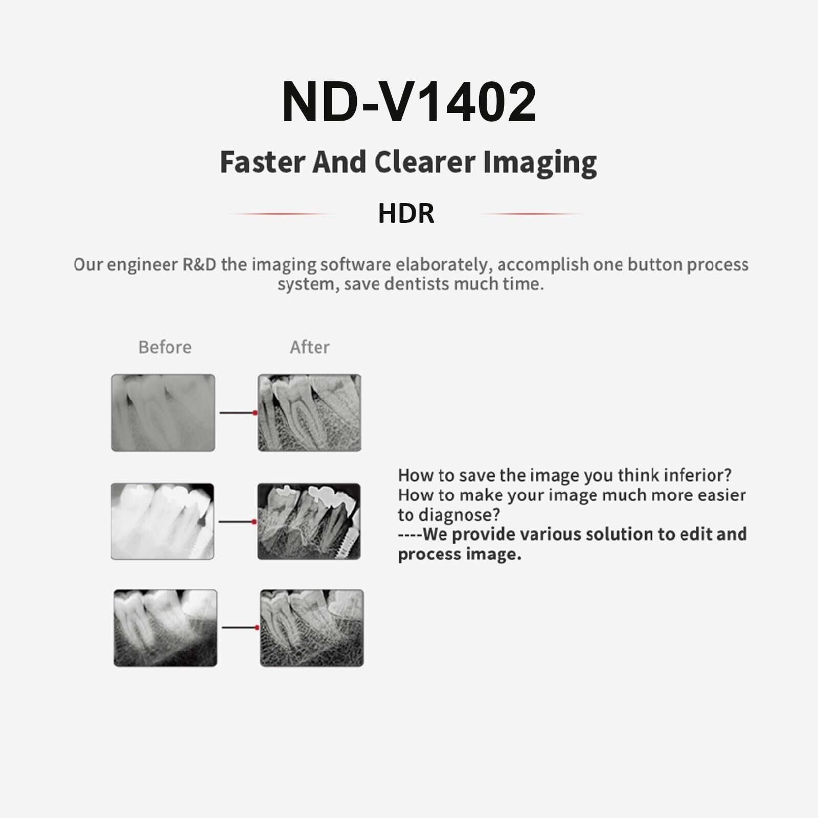 RVG Sensor HDR ND-V1402