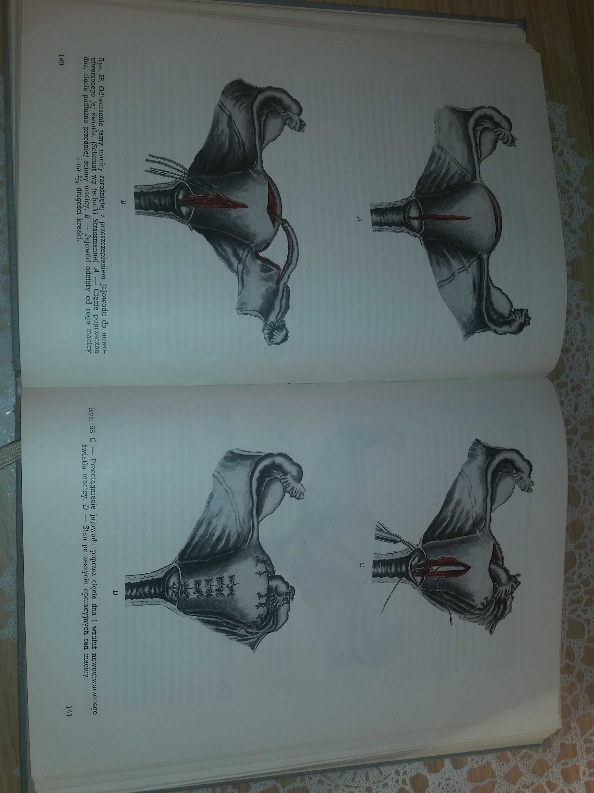 Niepłodność książka medyczna studenci lekarski ginekologia unikat