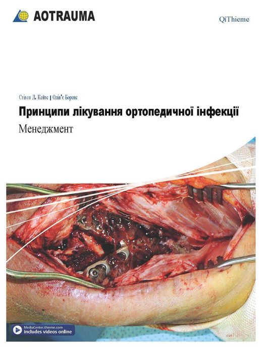 АО Принципи лікування ортопедичної інфекції  2016 р.