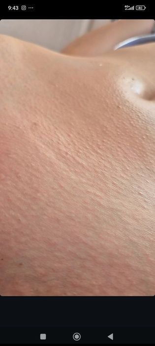 Шугаринг, Воскова депіляція ( чоловіча та жіноча)Інгульський район