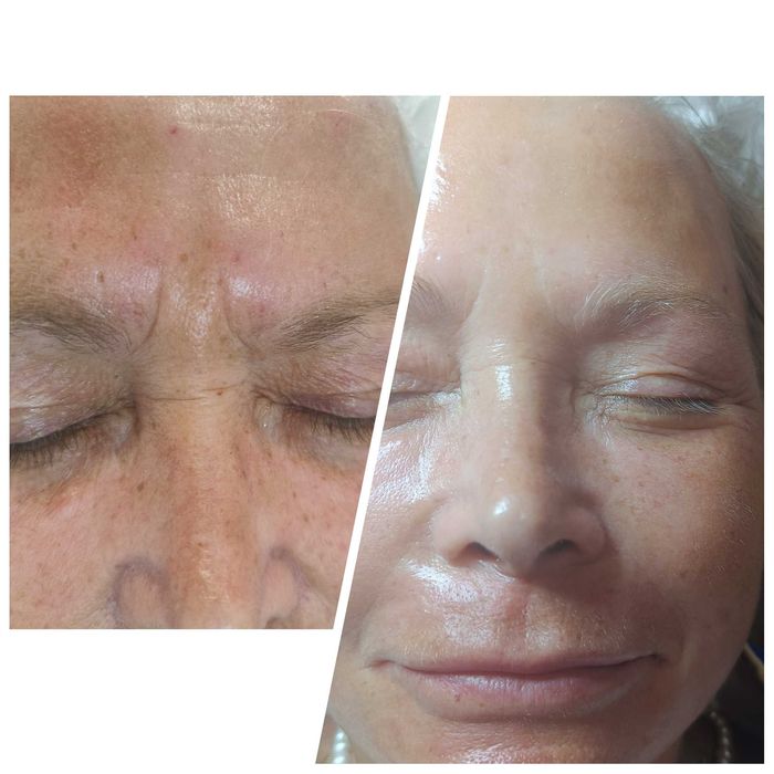 Опытный косметолог | Чистки, пилинги, инъекции