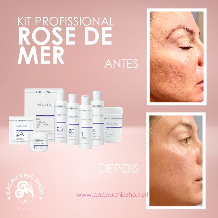 Kit Profissional! Rose de Mer Peeling Mecânico Limpeza de Pele Novo