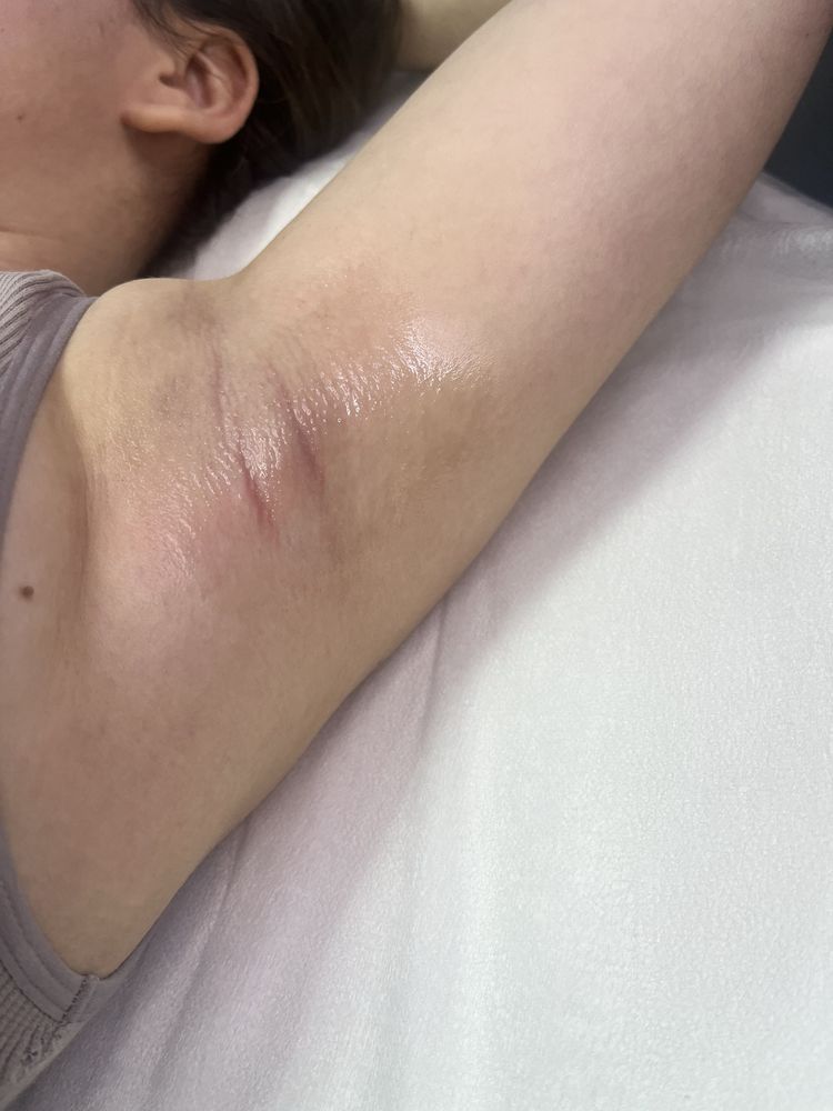 Депіляція метро Чернігівська, воскова депіляція шугаринг