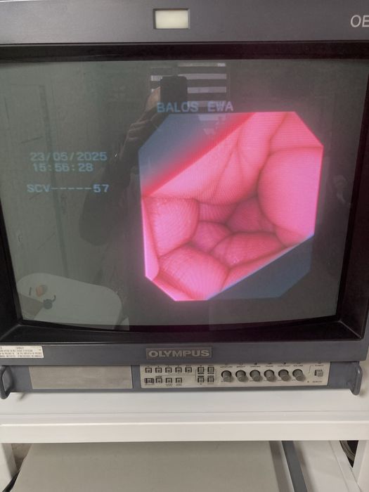 Ендоскоп гастроскоп стійка Олімпус