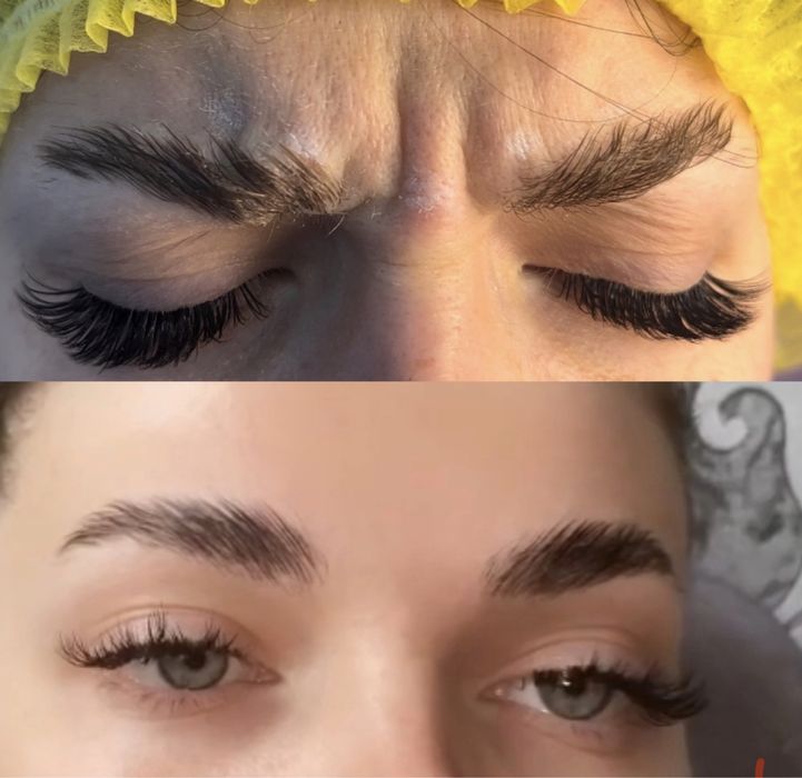 Ботокс| Все зоны | Одесса| Цент