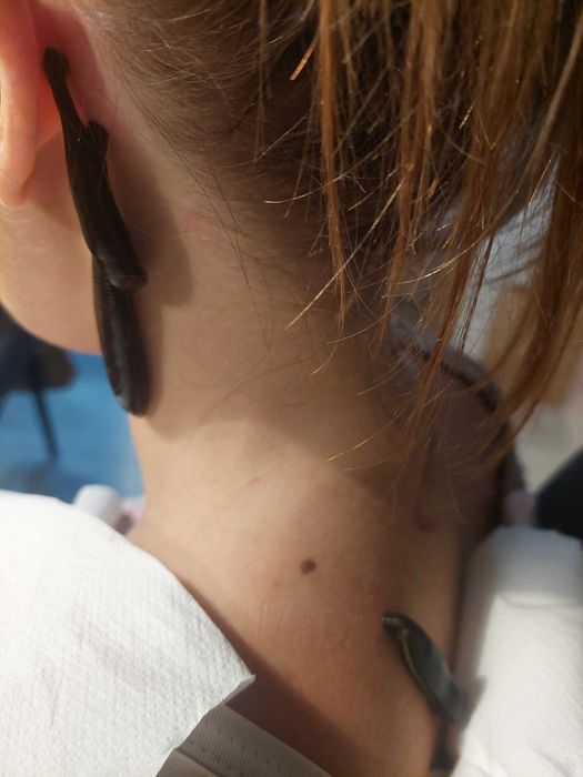 pijawki - stawianie pijawek z dojazdem do pacjenta Łódź