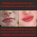 Kurs szkolenie z ust na płasko powiększania ust kwasem hialuronowym