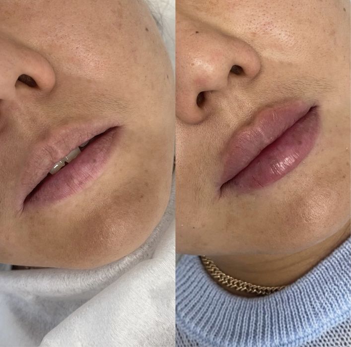 АКЦІЯ  Губи від 1500 грн, модель по собівартості, Київ, палац Україна