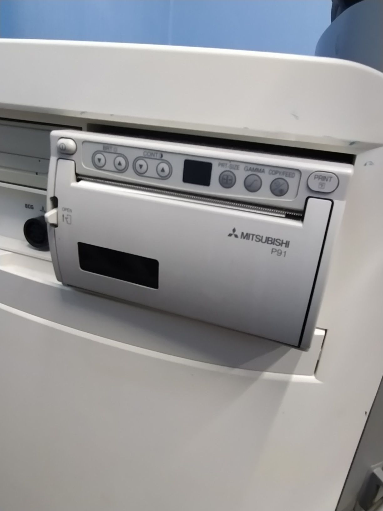 Апарат УЗД Siemens Acuson X300